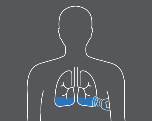 HFMS Fluid Monitoring