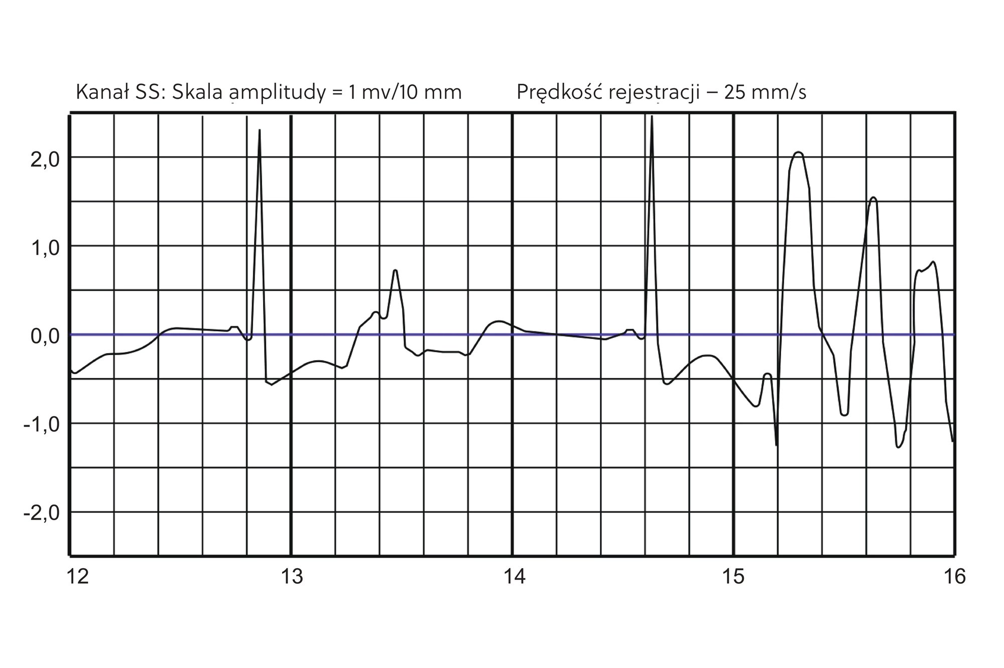 Wykres możliwości działania
