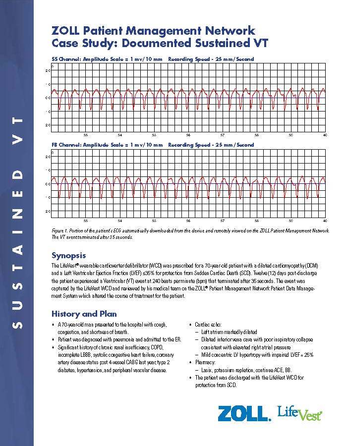 ZPM Network Documented Sustained VT_Page_1