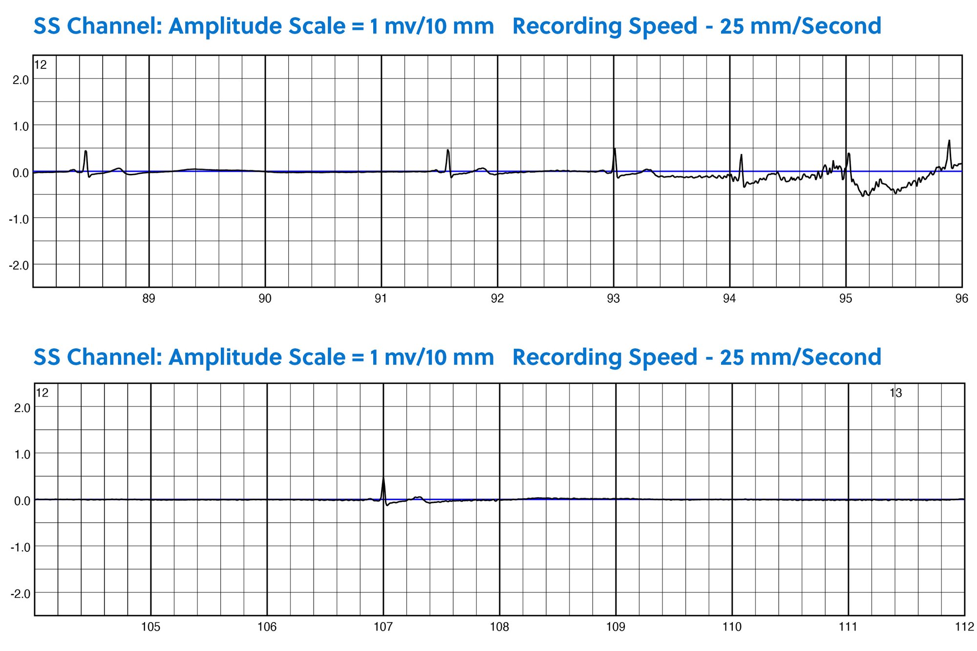 ZPM Trends Charts for Syncope