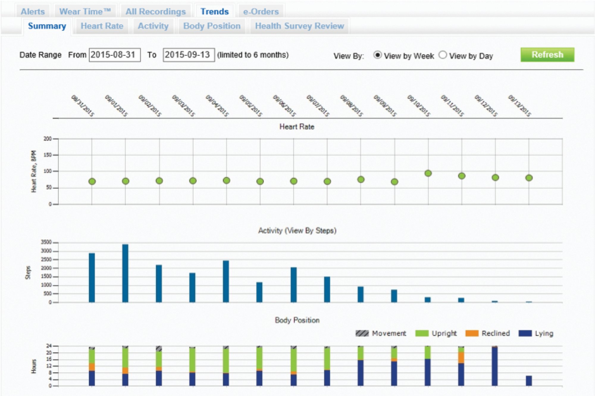 ZPM Trends Charts for 